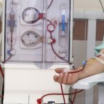 Patient receiving treatment with blood lines connected to discover how to make dialysis more successful.