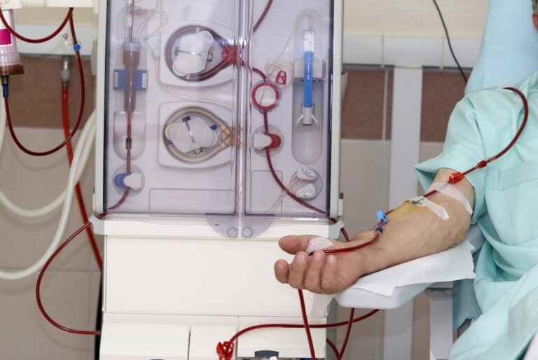 Patient receiving treatment with blood lines connected to discover how to make dialysis more successful.