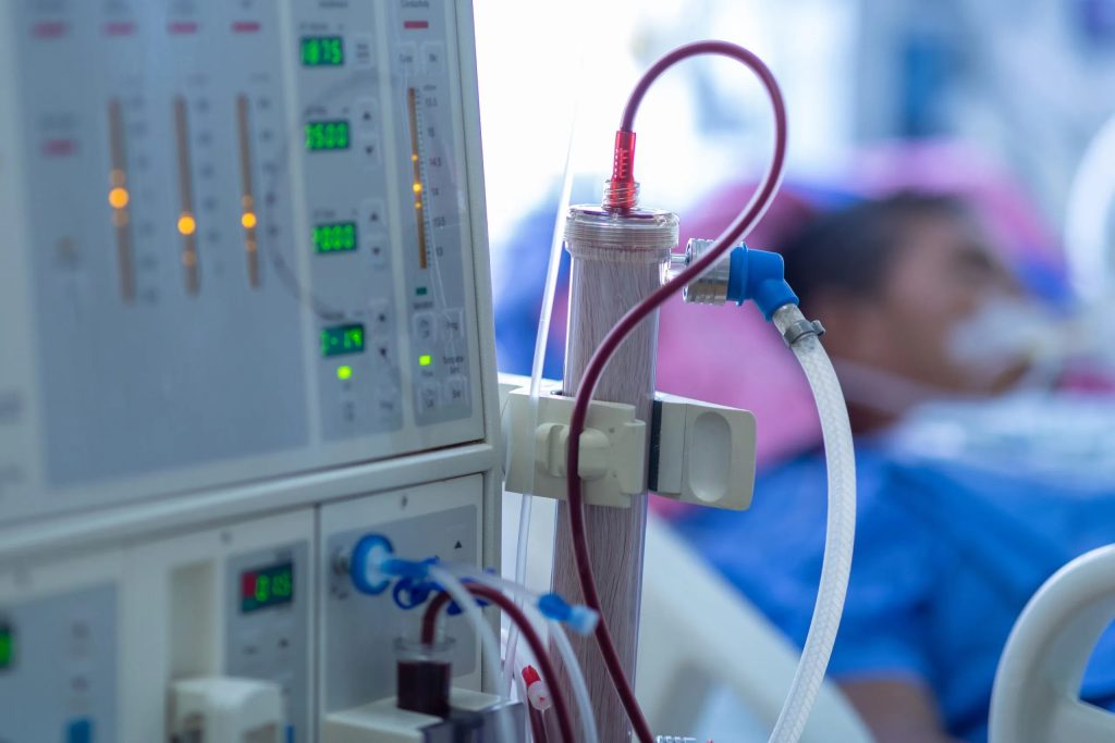 A hemodialysis machine with blood lines and pump running in a hospital setting, illustrating the complex process used to combat Inadequate Dialysis.