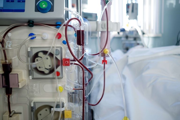 A close-up view of dialyzer tubes with blood flow and a blurry patient in the background, a sight that may be associated with Inadequate Dialysis.