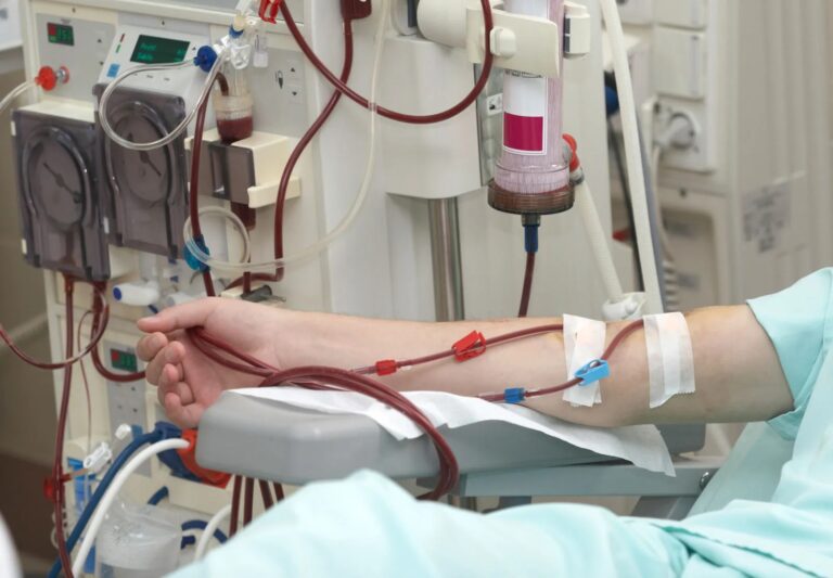 Patient undergoing hemodialysis treatment while following practical tips for dialysis patients.